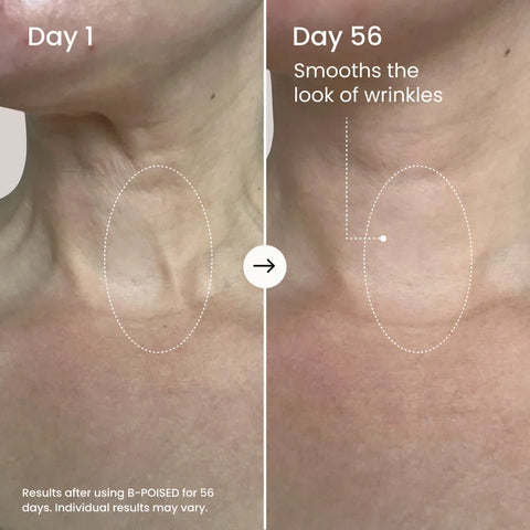 B-POISED Neck & Décolleté Firming Cream
